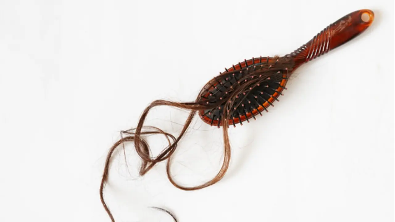 Injertos de Pelo