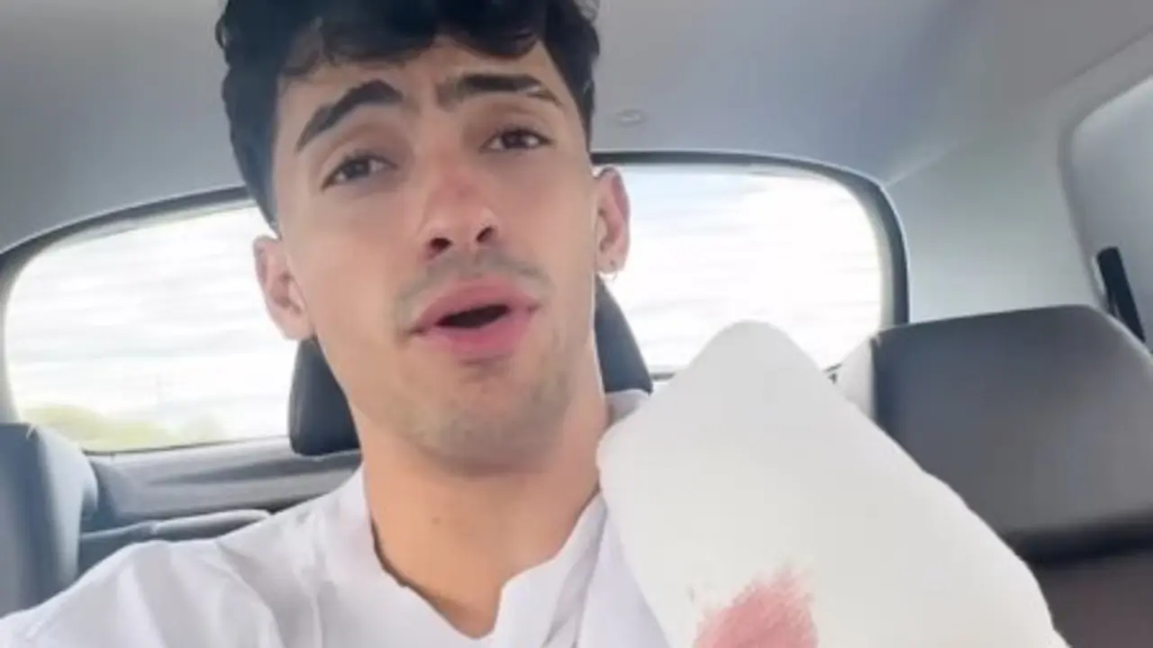 El influencer Gero Arias, tras el accidente. / IG