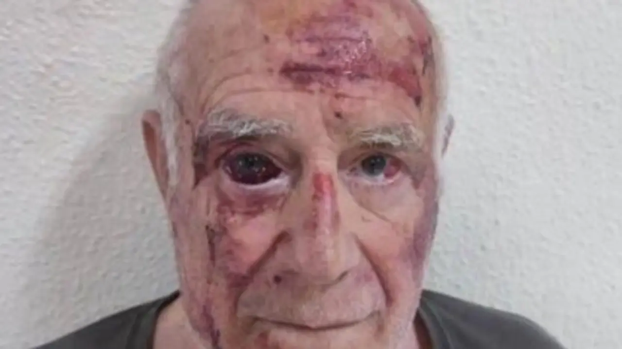 Domingo tras ser agredido en las calles de Torre Pacheco. / X