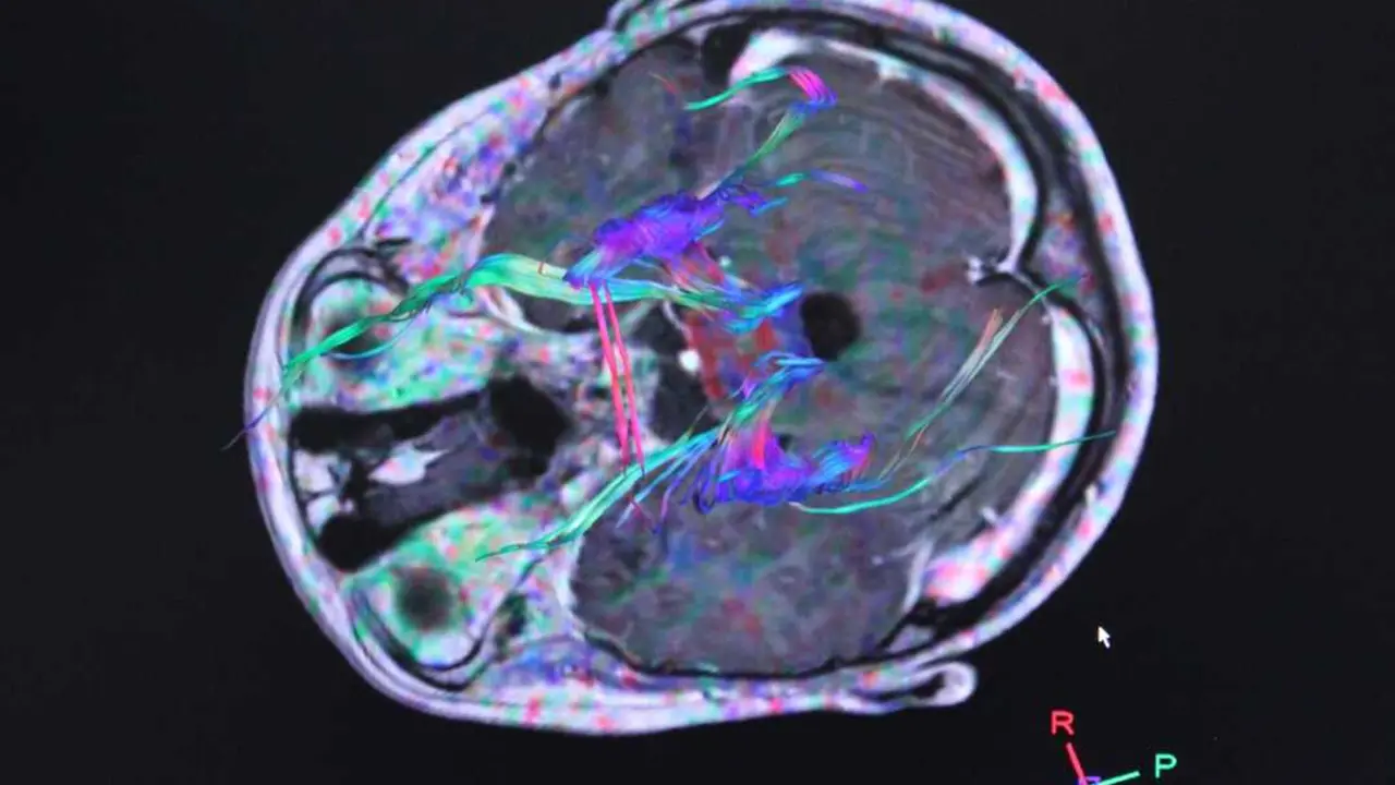 Imagen de archivo de la actividad del cerebro. / EP