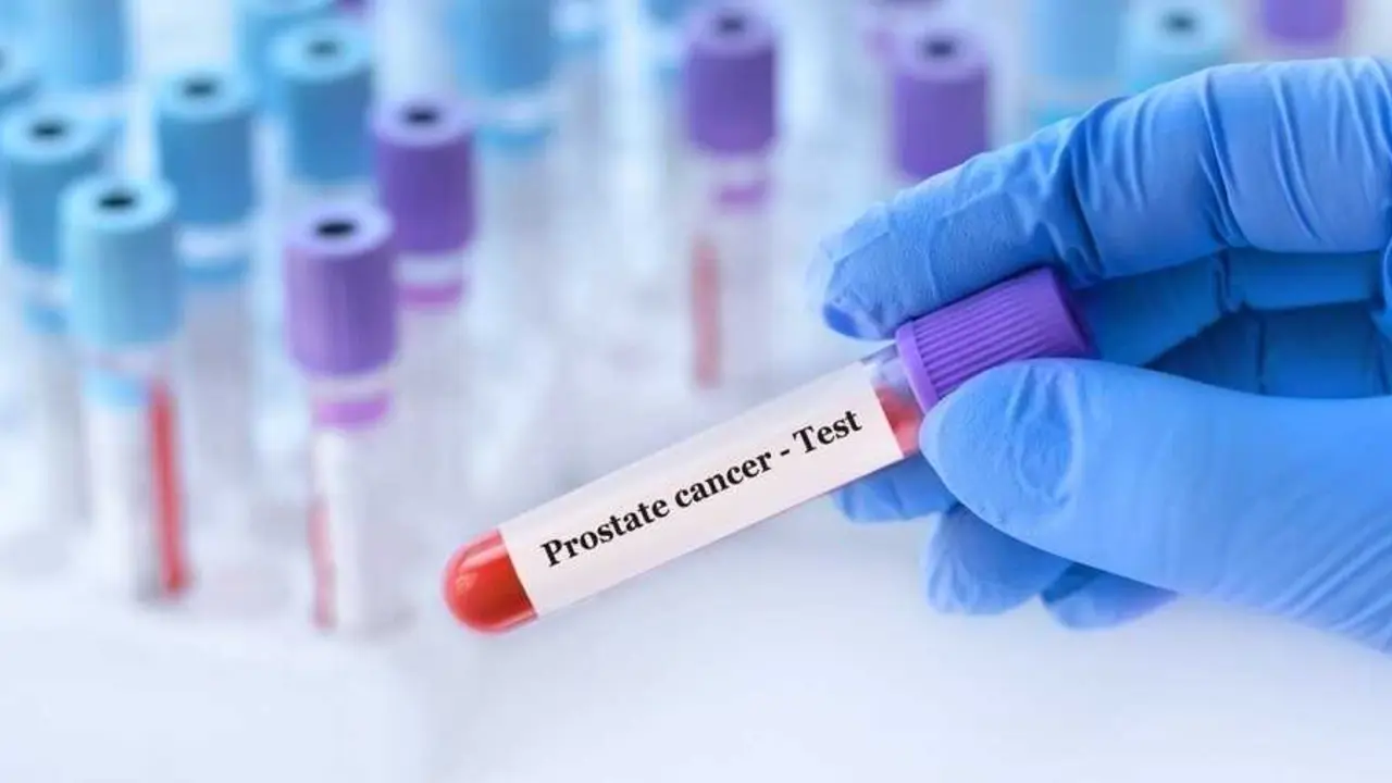 Abogan por el test del c&aacute;ncer de pr&oacute;stata. / EP